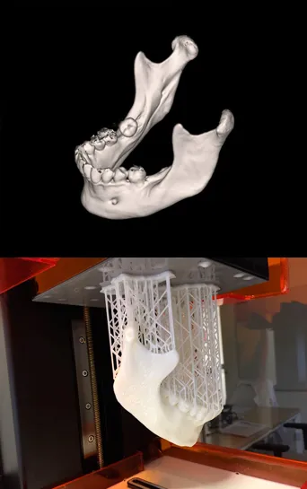 A 3d scan of a lower jaw and a replicated 3d model of the same bone structure