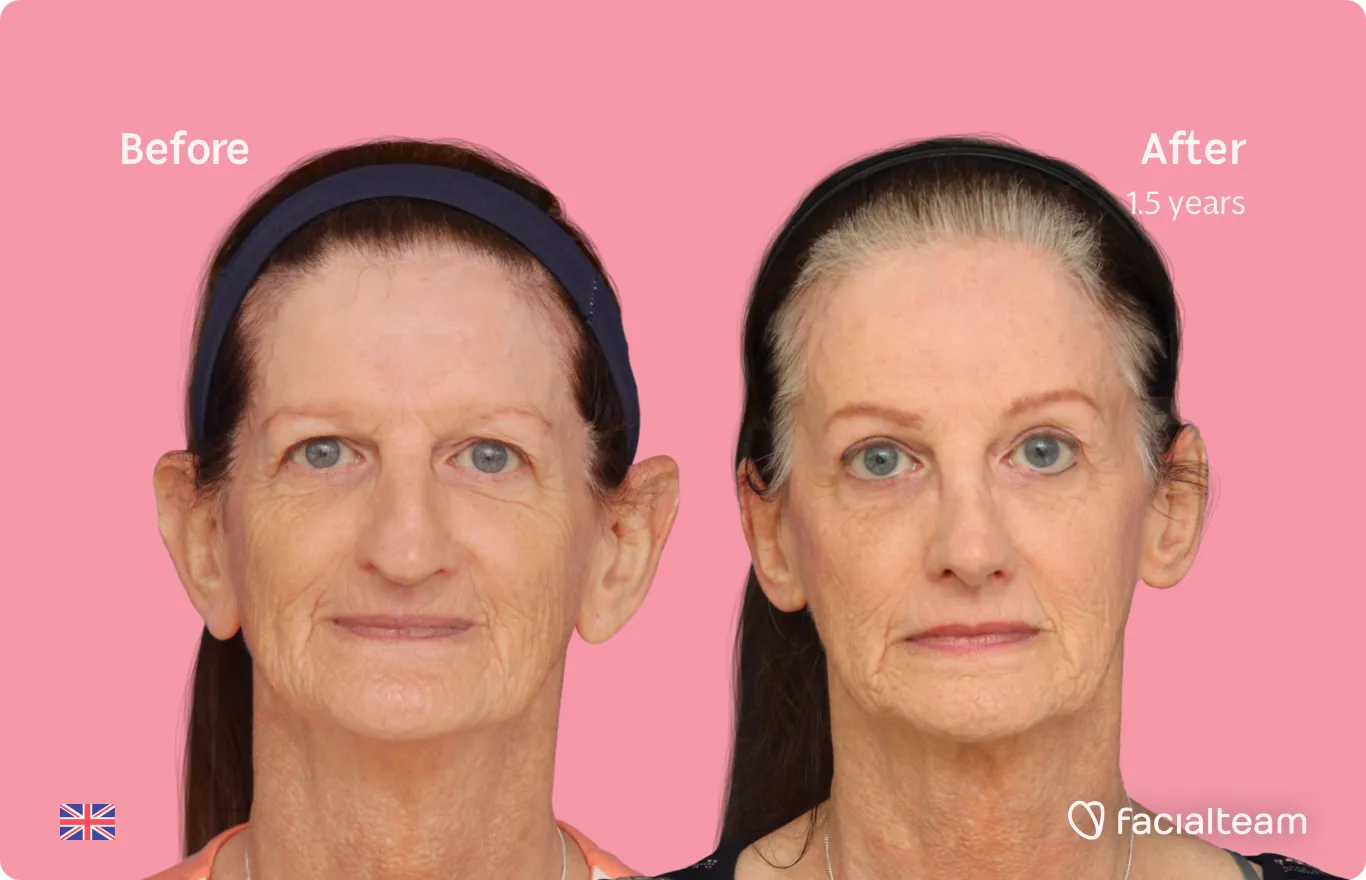 Transitioning at a Later Age. Is That Even Possible? — Facialteam