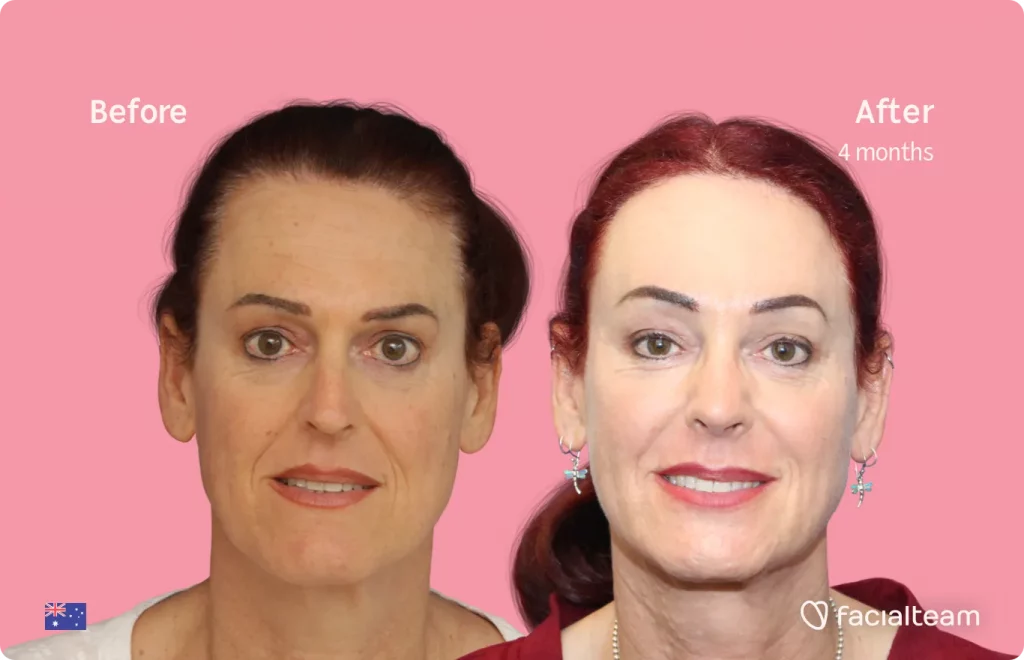 Transitioning at a Later Age. Is That Even Possible? — Facialteam