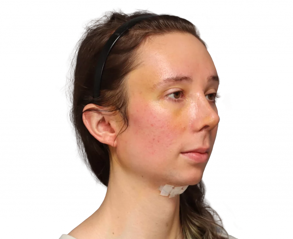 Angeled picture taken from Sasha after surgery