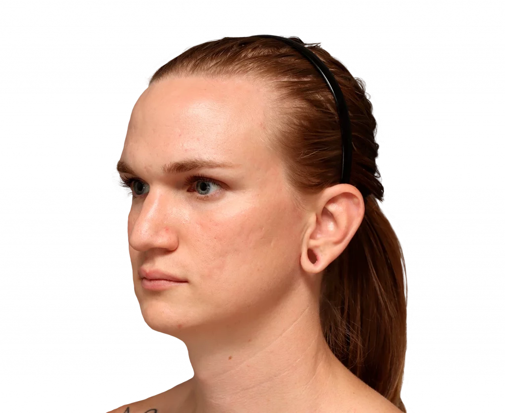 Angeled picture taken from Es before surgery