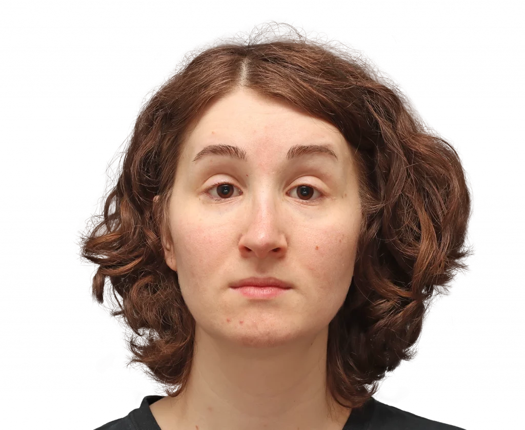 Front profile photo of Arly after surgery.