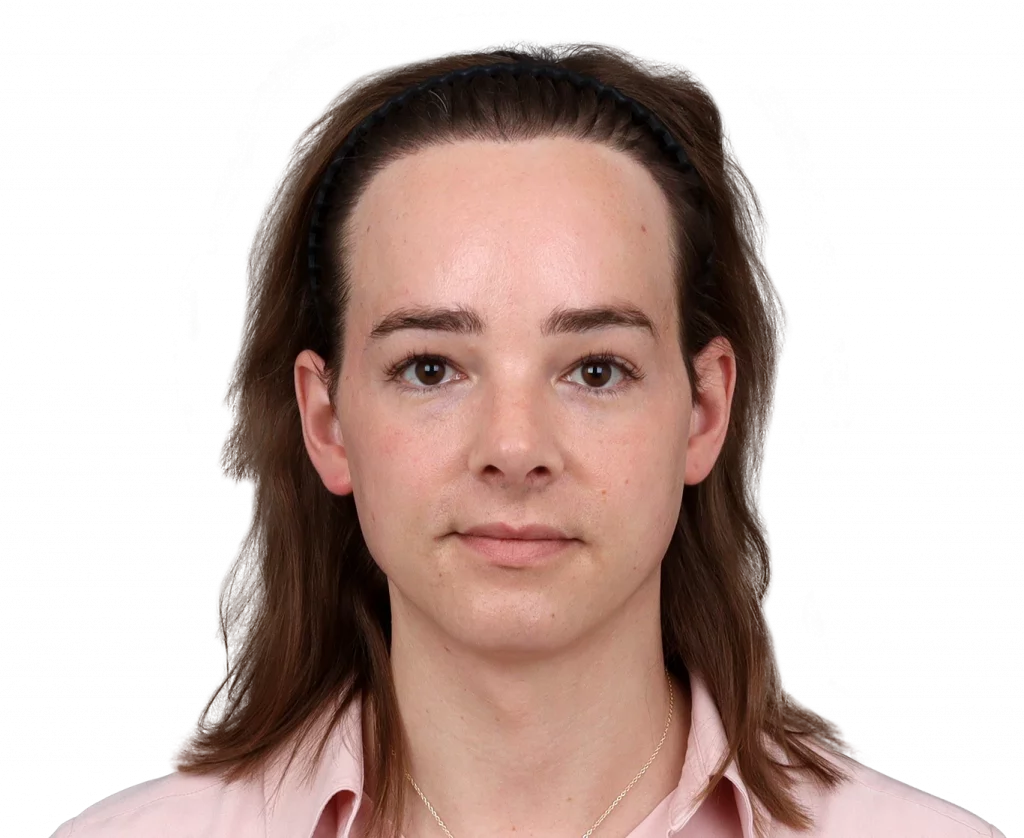 Front profile photo of Lilly Nea after surgery.