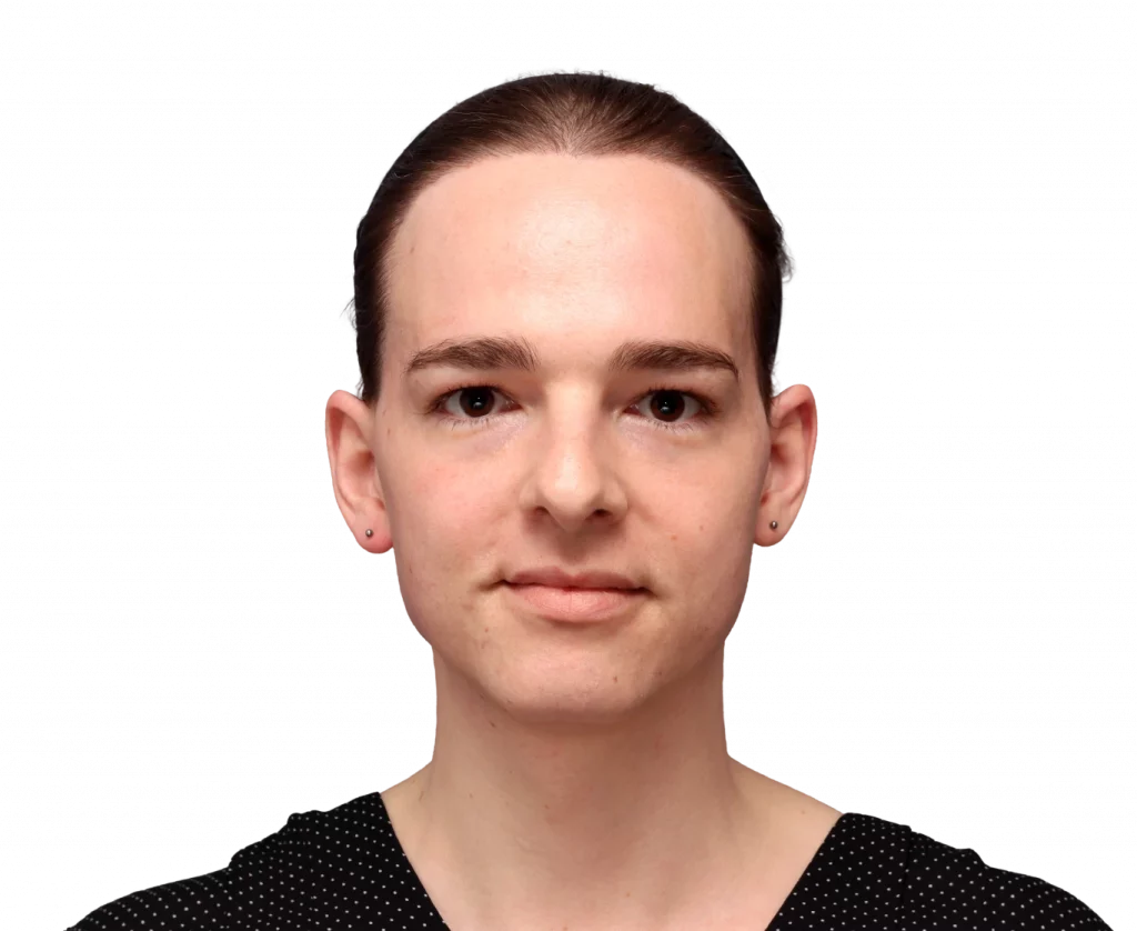 Front profile photo of Lilly Nea before surgery.