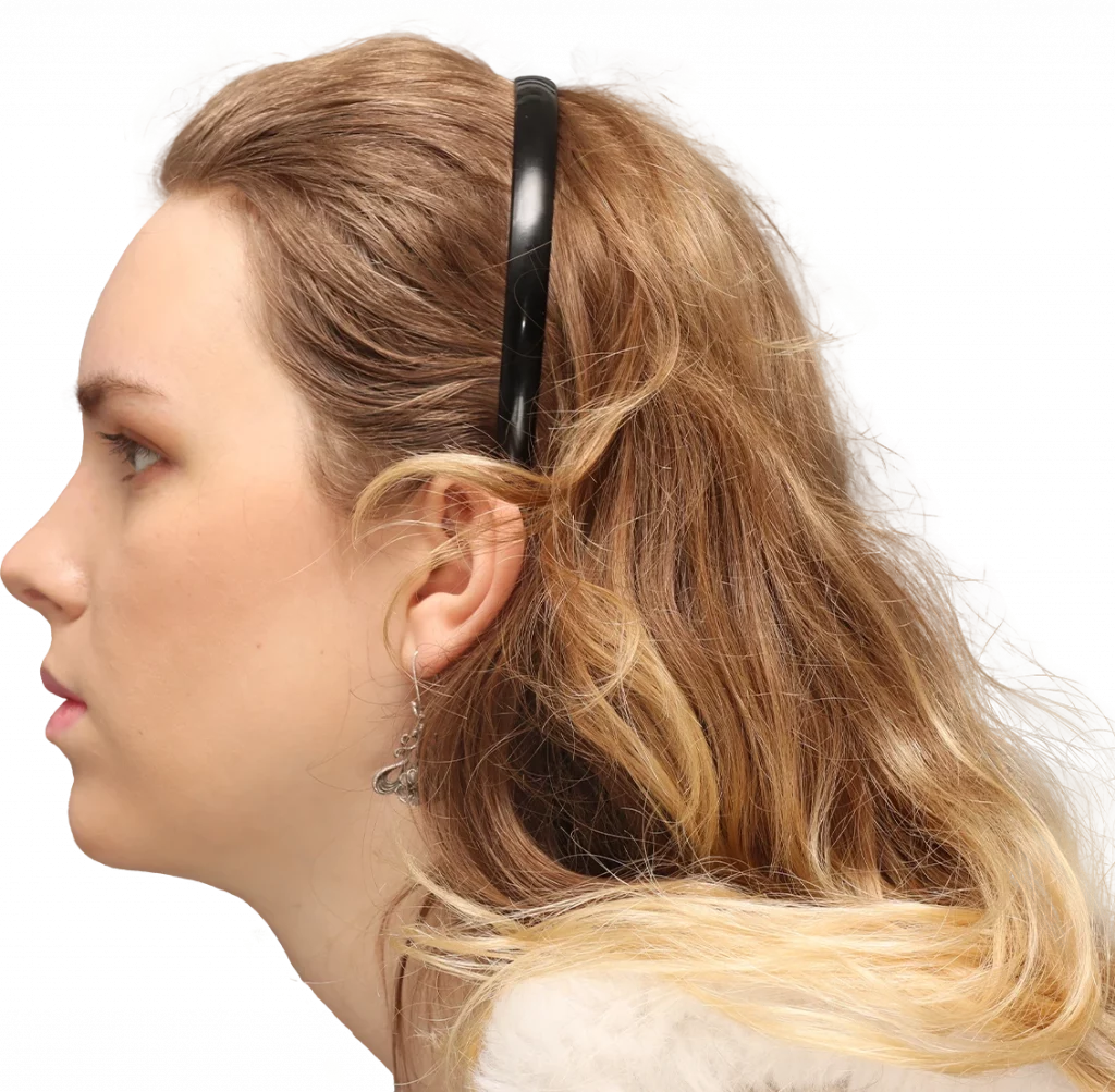 Side left profile photo of Lilly C. after surgery.