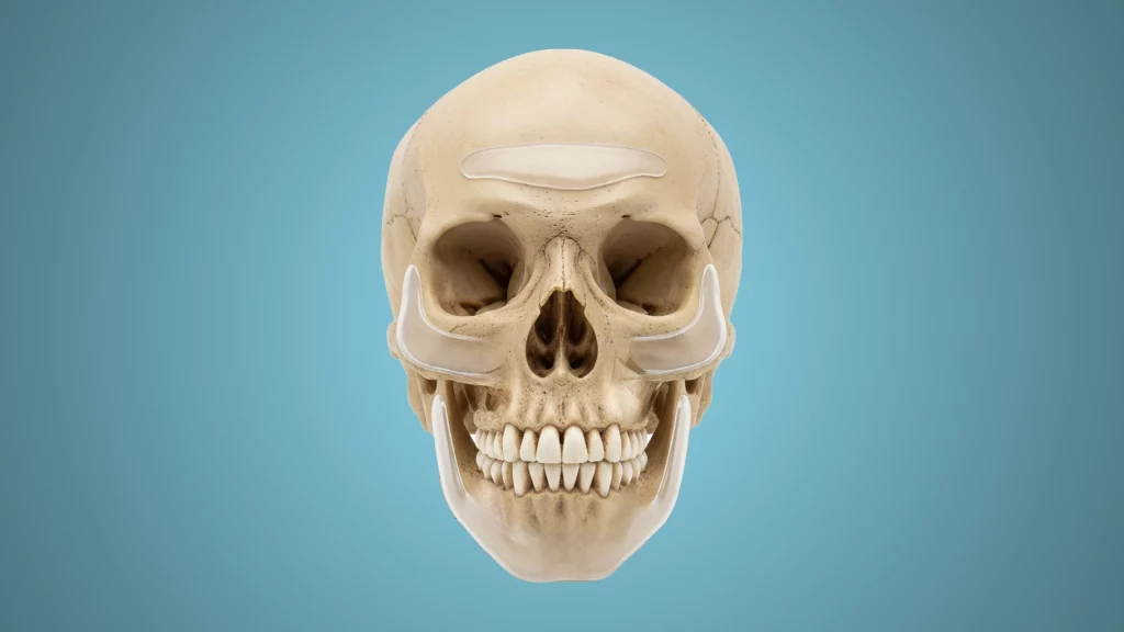 skull with implants to masculinize it