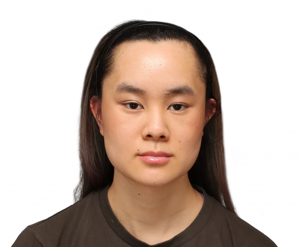 Frontal profile photo of Val after surgery.