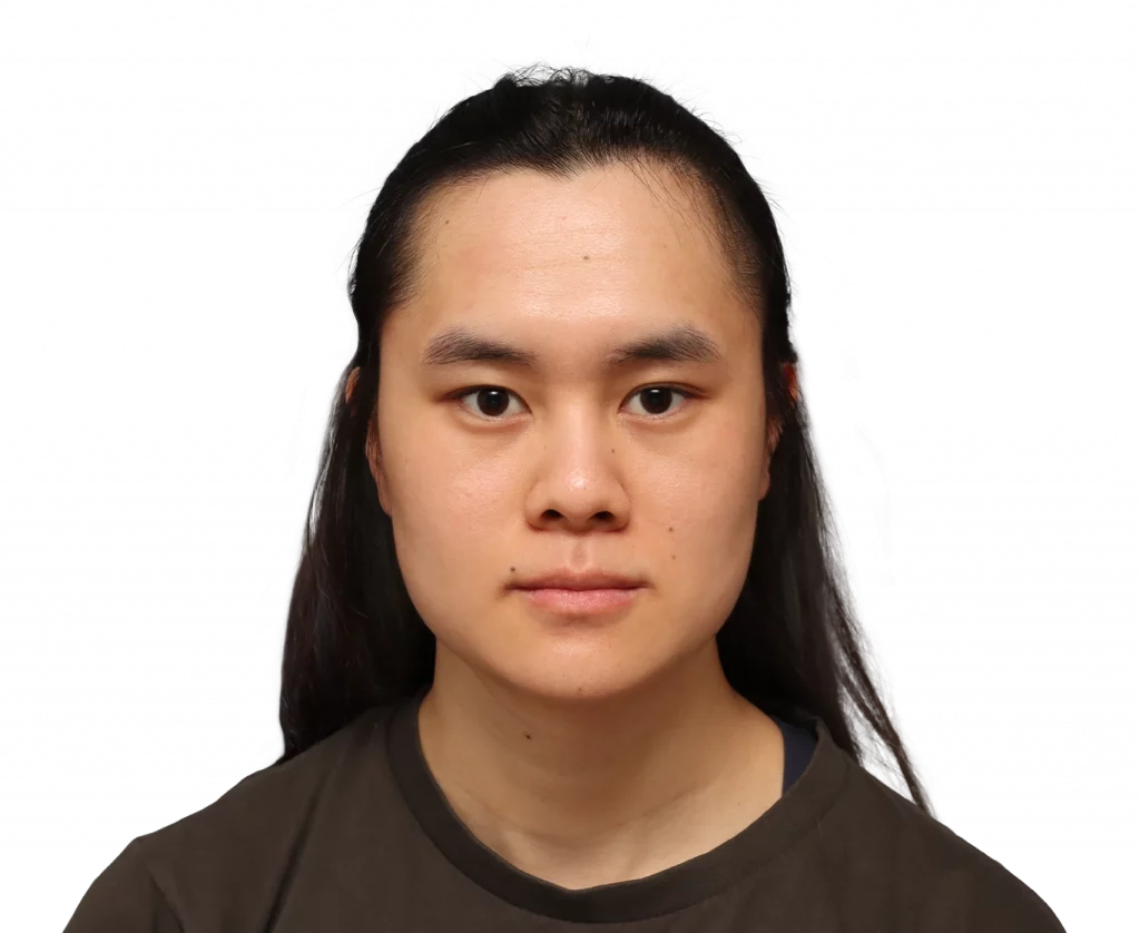 Frontal profile photo of Val before surgery.