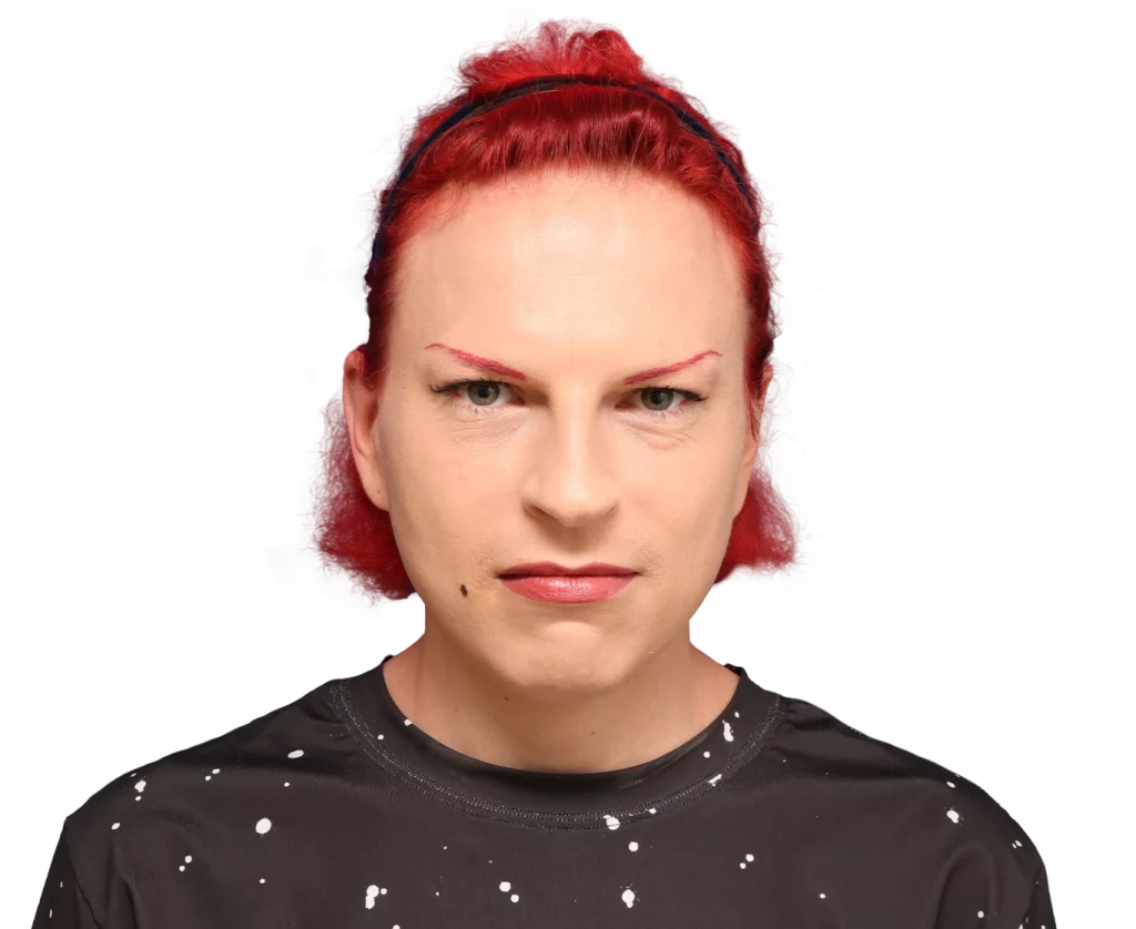 Frontal profile photo of Alexis before surgery.