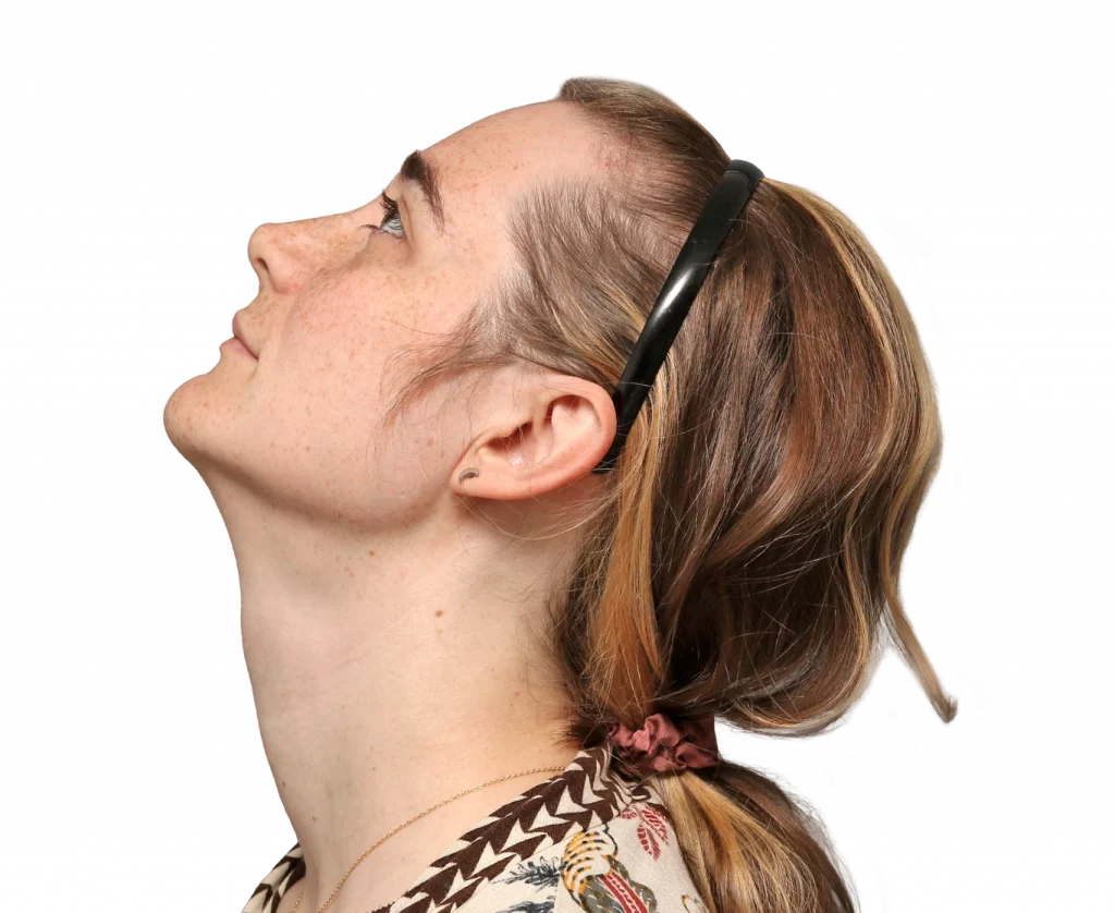 Side left up profile photo of Isabelle B. after surgery.