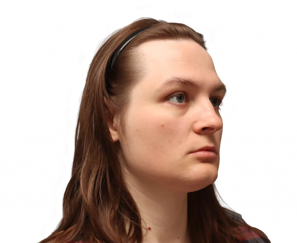 Angled right profile photo of Gertrude before surgery.