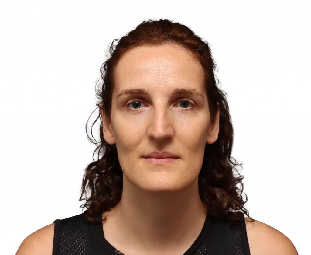 Frontal profile photo of Angelique D. before surgery.