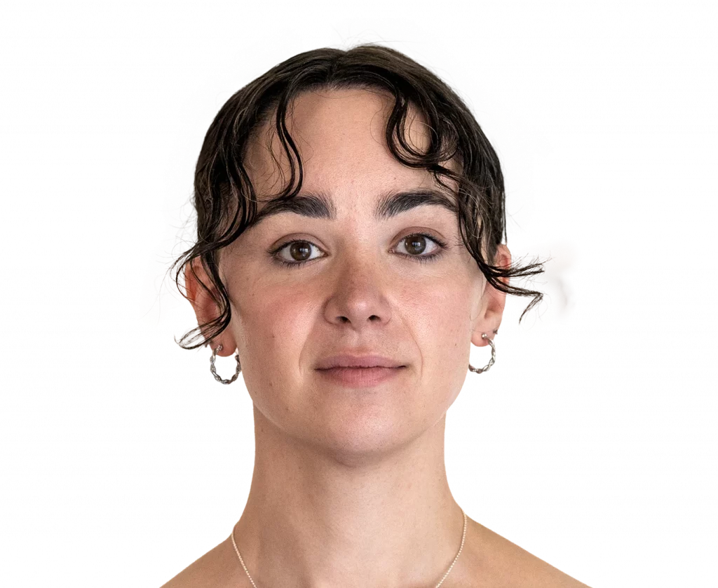Frontal profile photo of Elle D. after surgery.