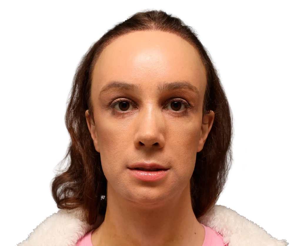 Close-up portrait of a woman facing the camera with a neutral expression, brown hair, pink top, and white fleece collar against a dark background.