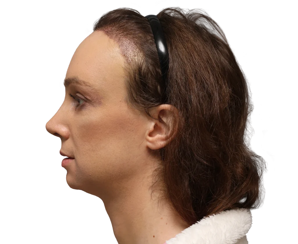 Side profile of a woman with brown hair wearing a black headband, facing left.