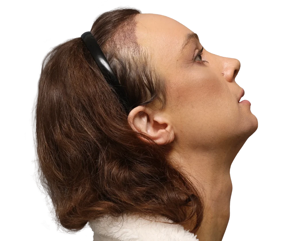 Profile of a woman wearing over-ear headphones, looking upward with a neutral expression