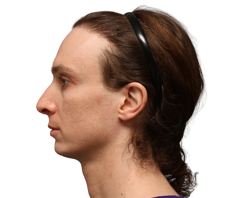 Profile of a woman with brown hair pulled back by a black headband, facing left, neutral expression.