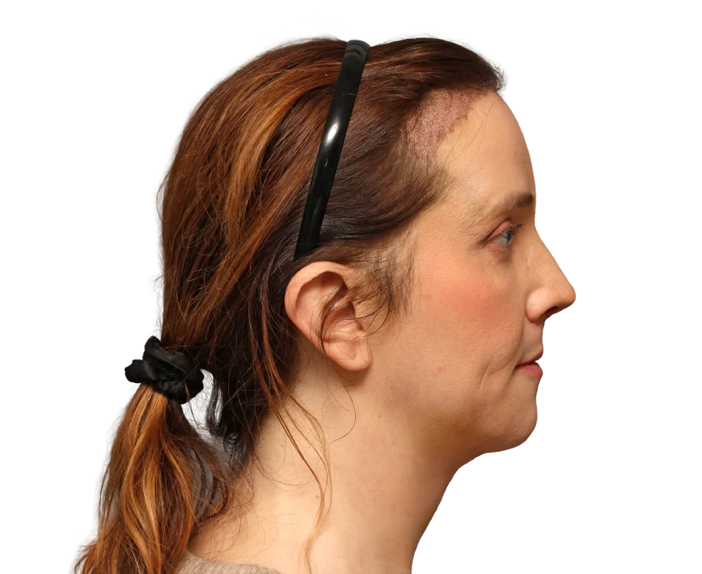 Side profile of a woman with auburn hair tied back, wearing a black headband.