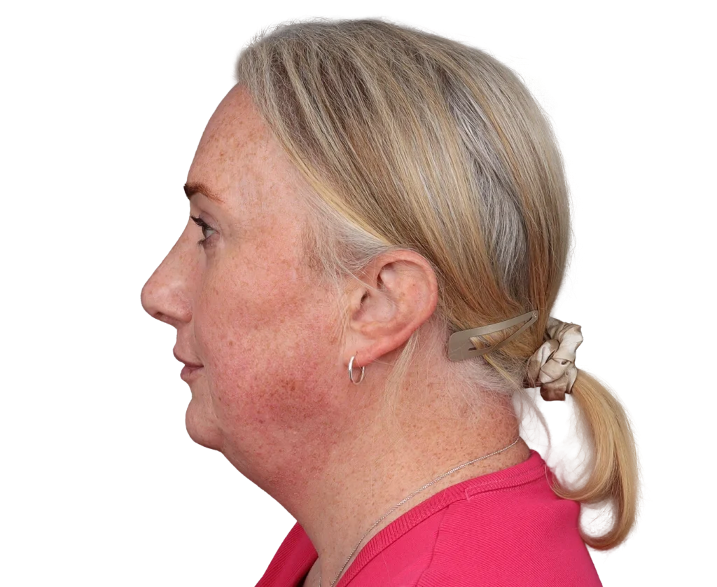 Side profile of a middle-aged woman with blonde hair in a low bun secured by a beige clip, wearing a pink top and a small hoop earring.