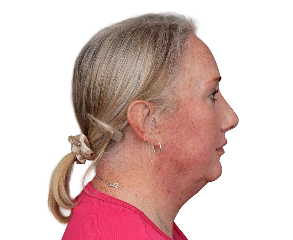 Side profile of an older woman with light hair tied back, wearing a pink top and a hair clip