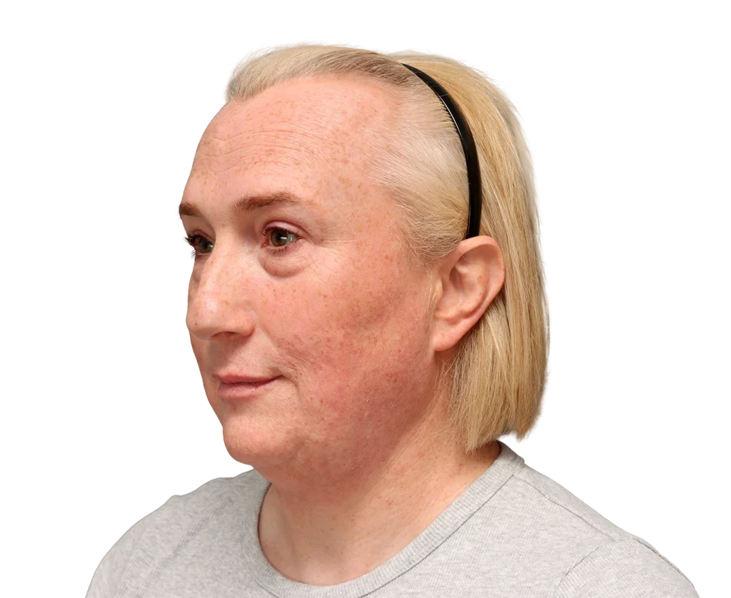 Close-up side profile of a middle-aged woman with blonde hair, freckles, and a black headband.