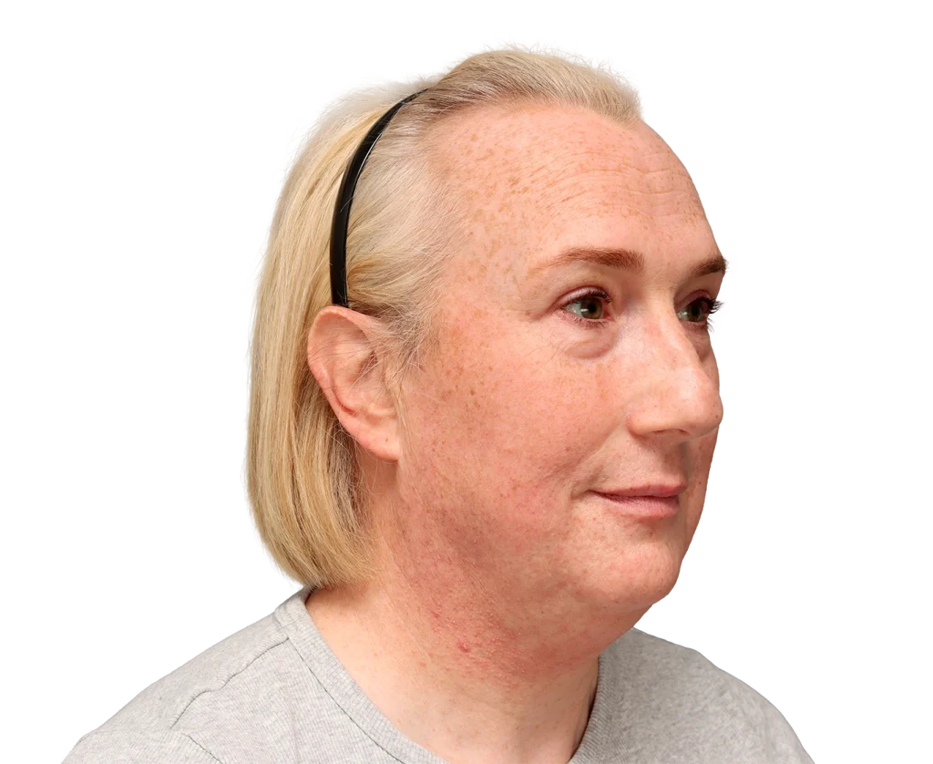 Profile view of a blonde woman with freckles, wearing a black headband and a gray shirt.