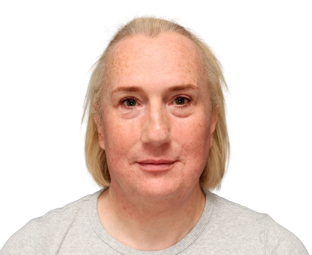 Front-facing head-and-shoulders portrait of a woman with light skin, short blonde hair, and freckles, wearing a gray shirt.
