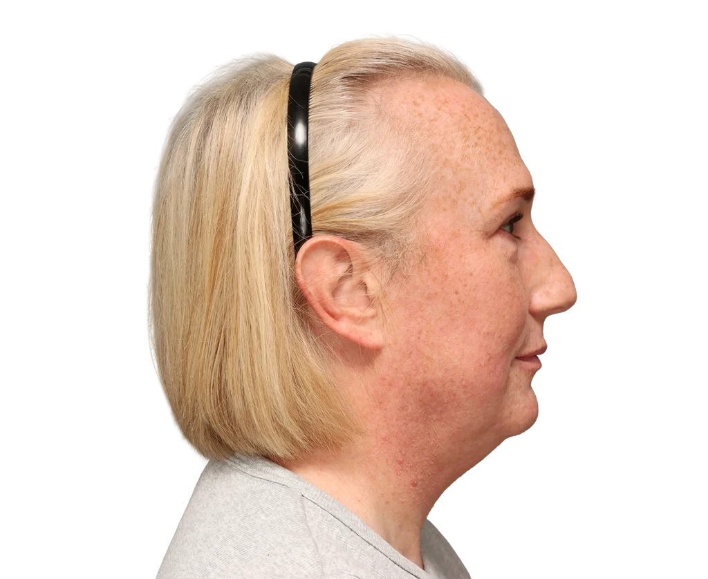 Profile view of a blonde woman wearing a black headband, with freckles on cheek and neck.