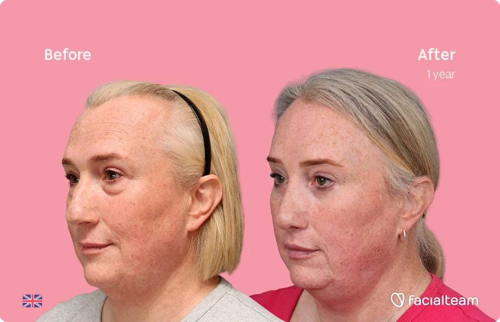 Side-by-side photo comparison: left 'Before' and right 'After 1 year' showing improved skin texture and reduced redness on the same person. Pink background.