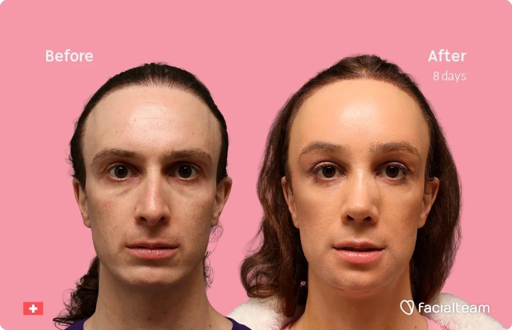 Before–After comparison: close-up of a woman's face on a pink background, left labeled 'Before' and right labeled 'After 8 days', showing improved skin texture.