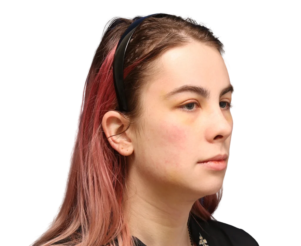 Side profile of Elléonore wearing a black headband, facing right, with pink-dyed hair.