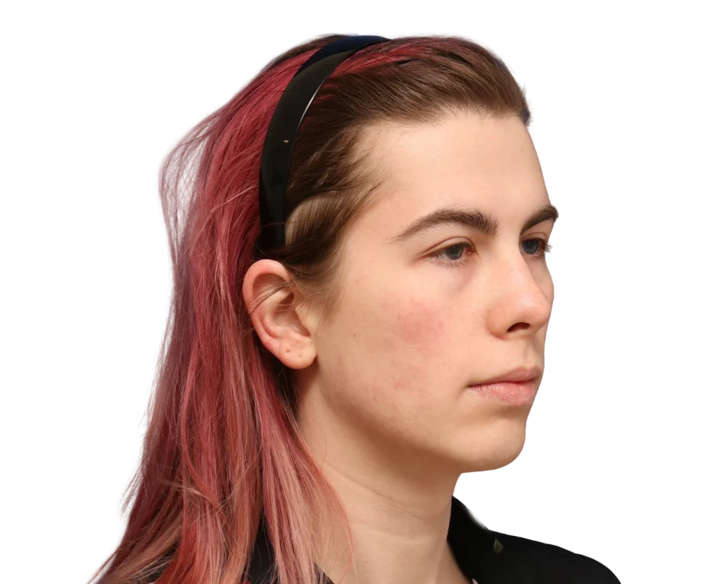 Side profile of Elléonore with pink-dyed hair and a black headband.