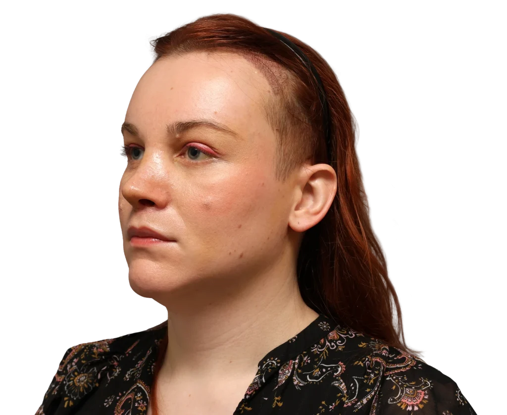 Portrait of a Mia with red hair in a black patterned blouse, wearing a thin headband, shown in a left three-quarter profile.