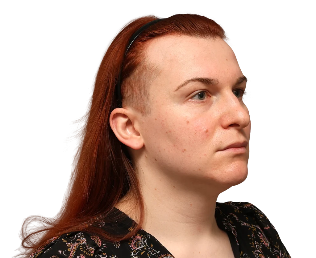 Profile shot of Mia with red hair, wearing a black headband, facing slightly to the right with a calm expression.