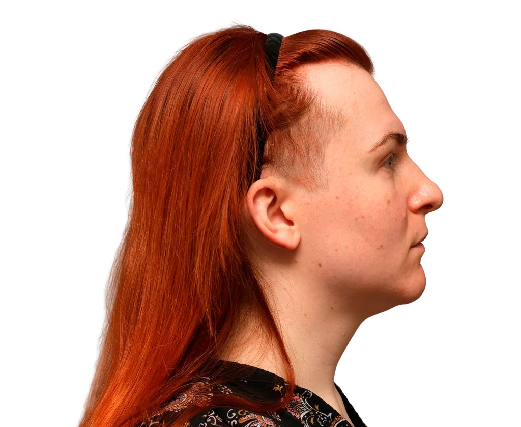 Side profile of Mia with bright red hair, wearing a black headband and sunglasses on top, showing freckles on pale skin against a black background