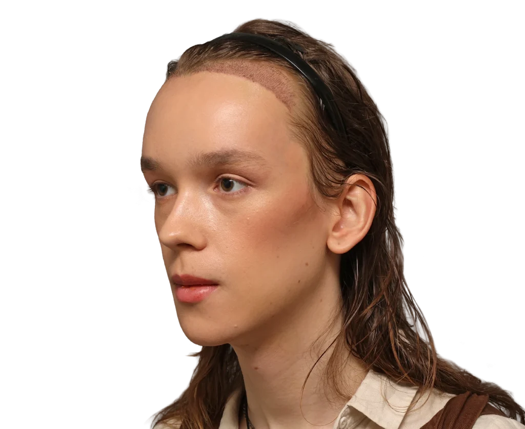 Close-up profile of a young Zoey with a hairline scar along her forehead, wearing a black headband.