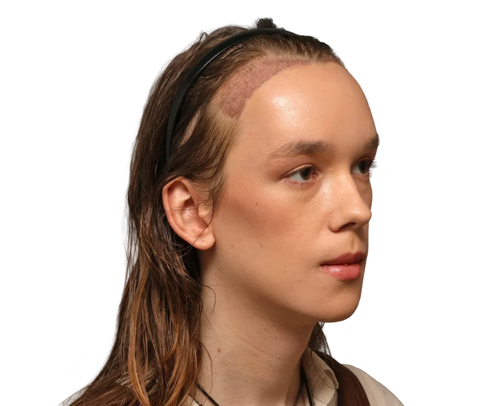Profile of a young Zoey with a shaved patch at the temple, wearing a black headband and long hair pulled back