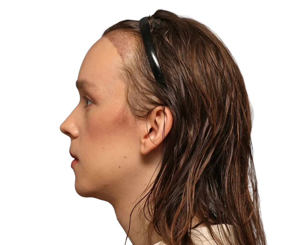 Profile of Zoey with a large scar along the hairline on her forehead, wearing a black headband over wet brown hair.