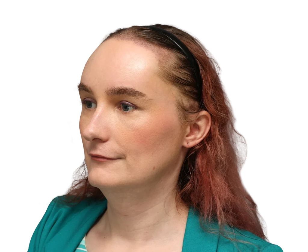Close-up side portrait of a woman with light skin, reddish-brown hair, wearing a teal top and a black headband, looking left.
