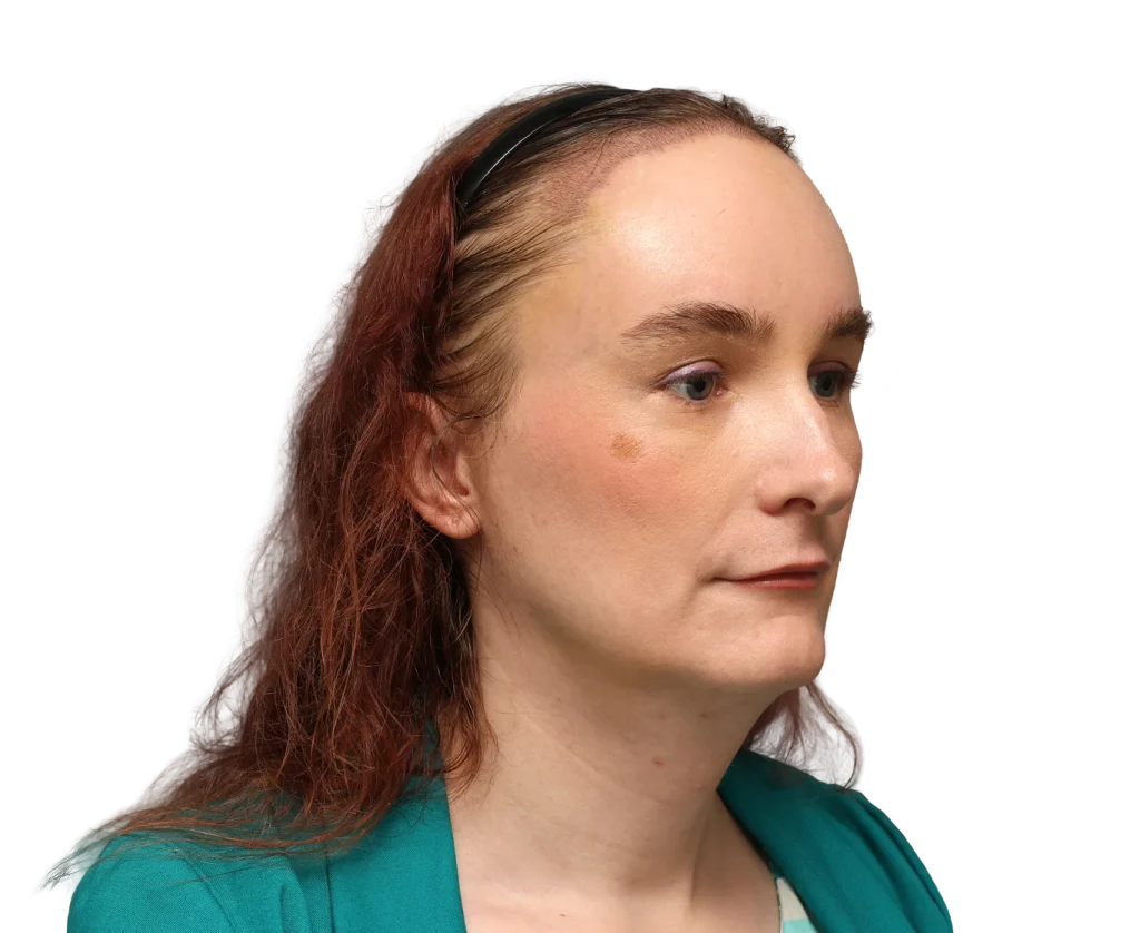 Profile view of a woman with reddish-brown hair in a black headband, wearing teal clothing, looking to the right.