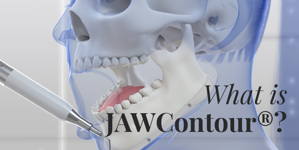 JAWContour - jaw and chin feminization